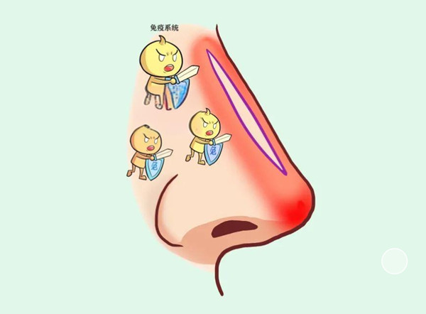 徐永丰鼻子为啥这么贵?谣言!别被忽悠了,徐永丰做鼻子价格大揭秘,不贵且值