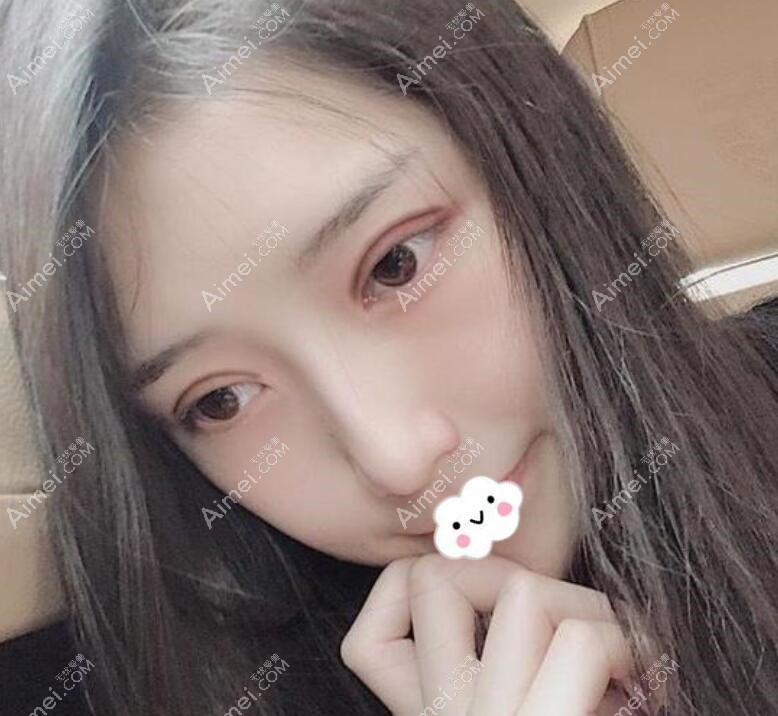 广州积美福田庆三眼综合案例