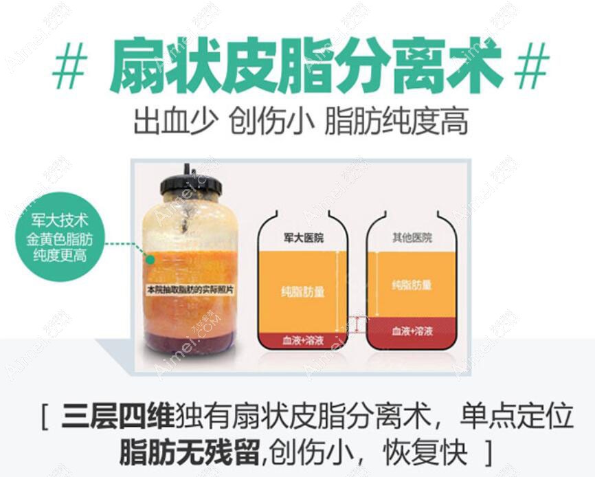 成都军大吸脂优势 成都军大吸脂优势