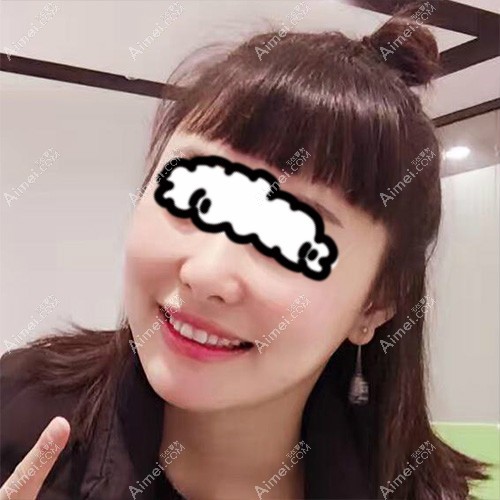 去杭州瑞丽找何涛主任做面光雕吸脂术后28天效果 去杭州瑞丽找何涛主任做面光雕吸脂术后28天效果
