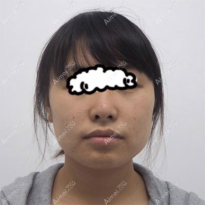 术前照片