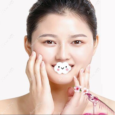 珠海爱思特隆鼻术后