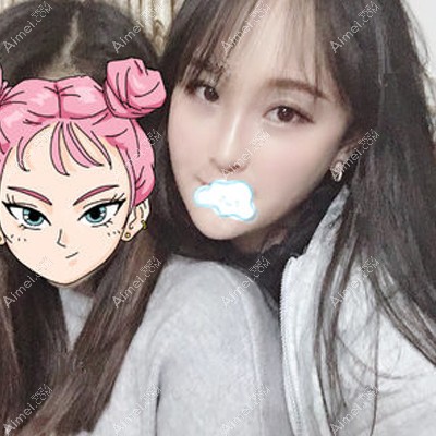 找韩勇做脂肪填充面部术后半年很自然 找韩勇做脂肪填充面部术后半年很自然