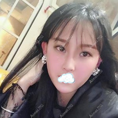 脂肪填充恢复1年后的效果超自然 脂肪填充恢复1年后的效果超自然