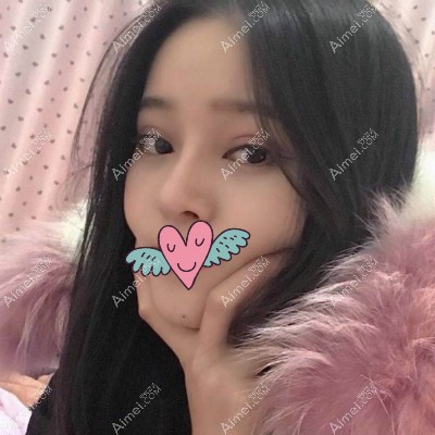 找杭州格莱美张霞飞割双眼皮手术30天恢复图 找杭州格莱美张霞飞割双眼皮手术30天恢复图