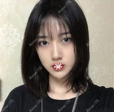 半年后眼睛很自然 半年后眼睛很自然
