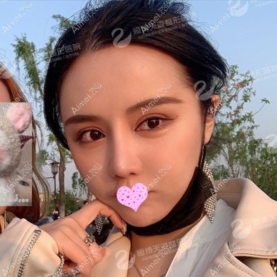 在成都做过脂肪填充的真实经历 在成都做过脂肪填充的真实经历