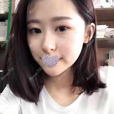 深圳千羽美容医院做海薇玻尿酸丰下巴 深圳千羽美容医院做海薇玻尿酸丰下巴