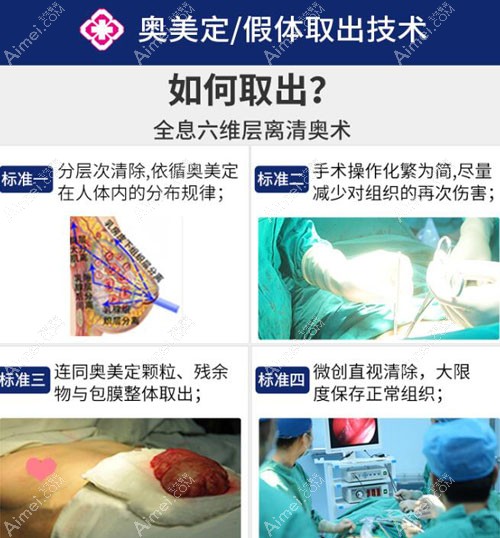 广州荔医全息六维层离取奥美定手术过程 广州荔医全息六维层离取奥美定手术过程