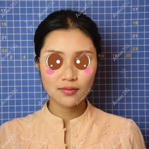 做肋软骨鼻综合前 做肋软骨鼻综合前