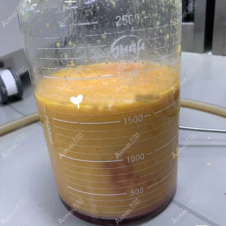 杭州静港大腿吸脂3000ml脂肪图片 杭州静港大腿吸脂3000ml脂肪图片
