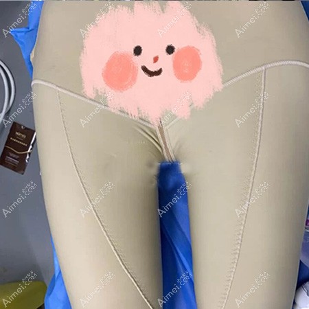 在杭州静港做大腿环吸第3天 在杭州静港做大腿环吸第3天