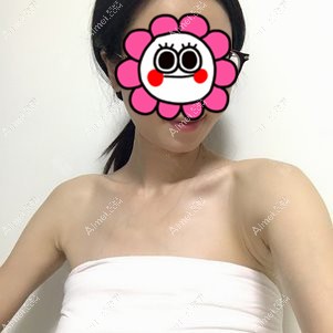 术后10天到医院拆线 术后10天到医院拆线