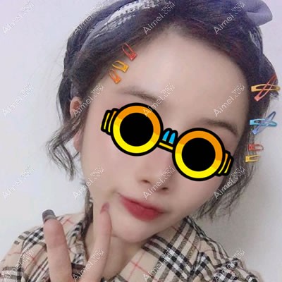 脂肪填充法令纹一年后的恢复效果图 脂肪填充法令纹一年后的恢复效果图