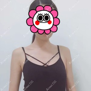 到乌鲁木齐华美做假体隆胸前 到乌鲁木齐华美做假体隆胸前
