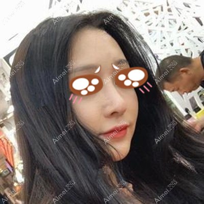 术后