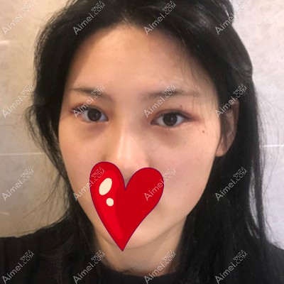 14_meitu_1