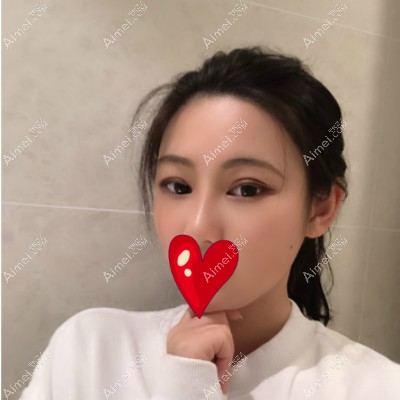 刘歆医生给我做完9毫米双眼皮20天后的恢复图片 刘歆医生给我做完9毫米双眼皮20天后的恢复图片