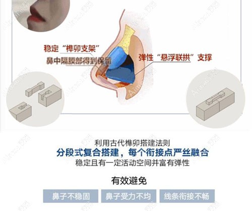 成都西区医院邓东伟8C骨雕鼻优势 成都西区医院邓东伟8C骨雕鼻优势