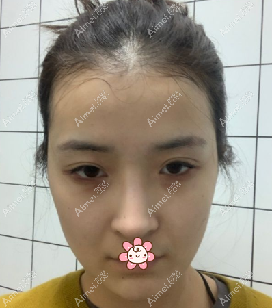 我还没做手术前的样子 我还没做手术前的样子