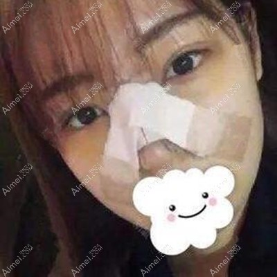 术后第五天并没有什么疼痛感 术后第五天并没有什么疼痛感