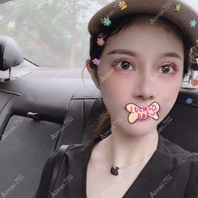 做面部填充脂肪术后20天恢复情况 做面部填充脂肪术后20天恢复情况