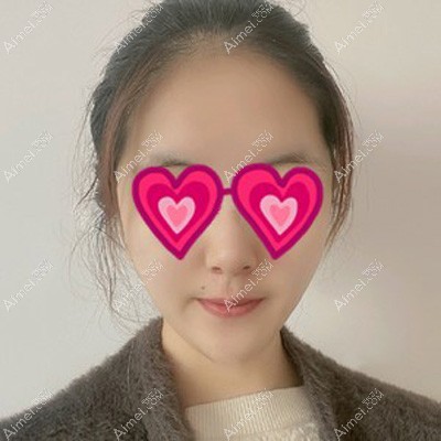 面部吸脂术后3天轻微肿胀 面部吸脂术后3天轻微肿胀