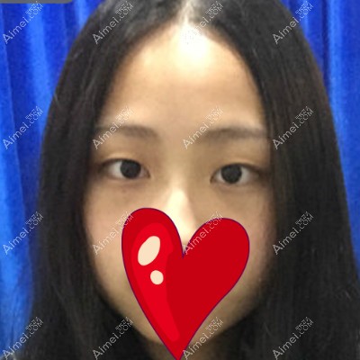 术前_meitu_5