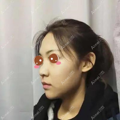 术前
