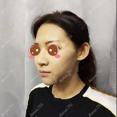 术后