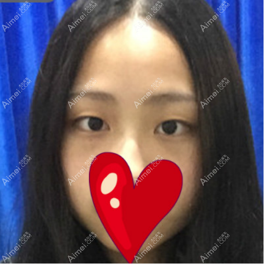 20201015589238.png image.png