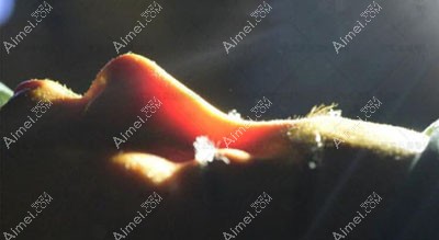 鼻子假体透光怎么掩盖 鼻子假体透光怎么掩盖