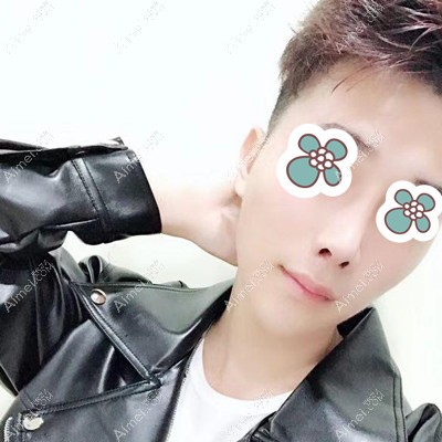 在包头华美做鼻部整形术后四个月效果分享 在包头华美做鼻部整形术后四个月效果分享
