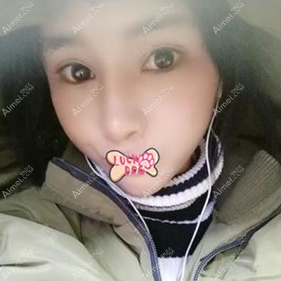 在南宁韩成做脂肪填充面部术后1个月恢复效果 在南宁韩成做脂肪填充面部术后1个月恢复效果