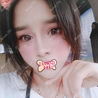 在南宁韩成做面填术后半年恢复自然 在南宁韩成做面填术后半年恢复自然