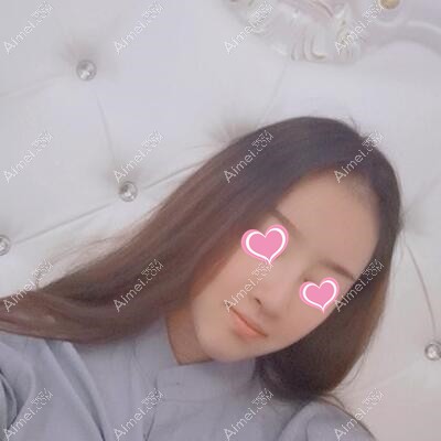 在天津联合丽格做完硅胶假体隆鼻后让我变漂亮了太多