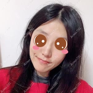 找重庆姜民范医生做下颌角一个月 找重庆姜民范医生做下颌角一个月