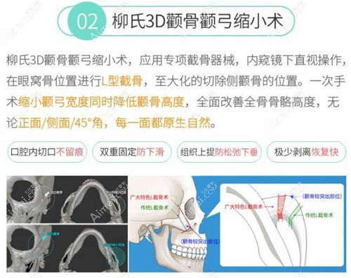 广州广大柳超磨骨优势 广州广大柳超磨骨优势