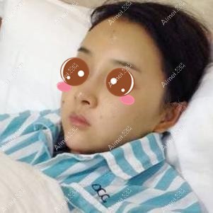 在重启徐铎丽格做二次脂肪填充术后休息 在重启徐铎丽格做二次脂肪填充术后休息