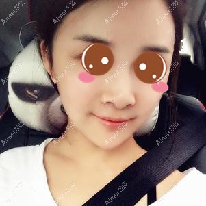 在重启徐铎丽格做二次脂肪填充术后3天 在重启徐铎丽格做二次脂肪填充术后3天