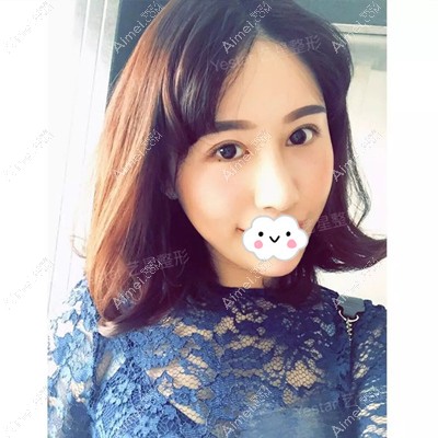 术后