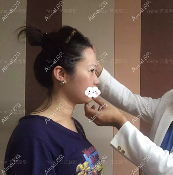 长沙艺星的秦晓东医生做术前面诊 长沙艺星的秦晓东医生做术前面诊