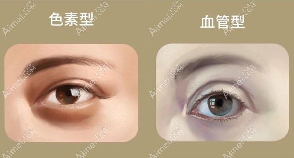 20201106639291.jpg 黑眼圈.jpg