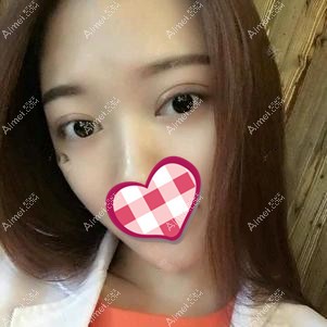 修复后十一天效果 修复后十一天效果