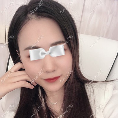 在南宁你美做注射垫下巴一周后恢复自然 在南宁你美做注射垫下巴一周后恢复自然