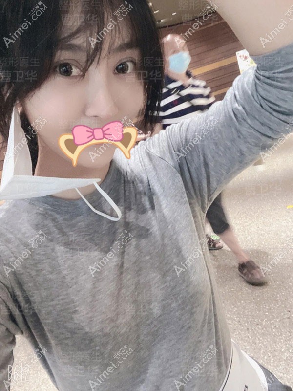 20201110390072.jpg 术后60天_副本_meitu_6.jpg