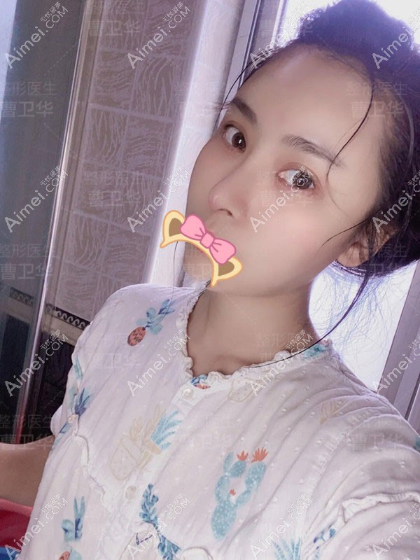 20201110744798.jpg 术后15天_副本_meitu_8.jpg