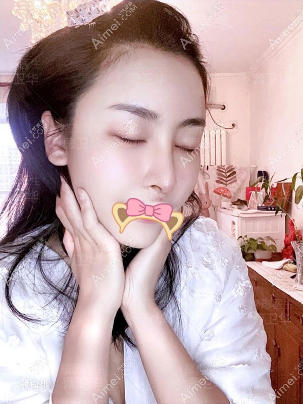 20201110785795.jpg 术后7天_副本_meitu_2.jpg