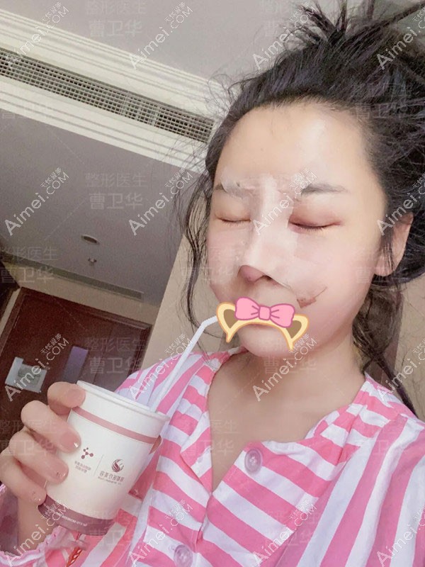 20201110933447.jpg 术后4天_副本_meitu_1.jpg