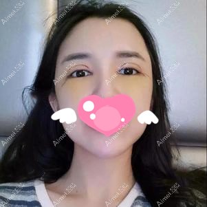 眼综合术后3天恢复期 眼综合术后3天恢复期